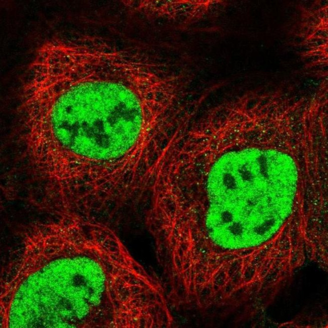 RBM15 Antibody in Immunocytochemistry (ICC/IF)