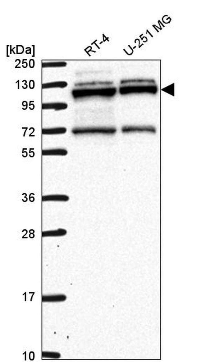 RBM15 Antibody in Western Blot (WB)