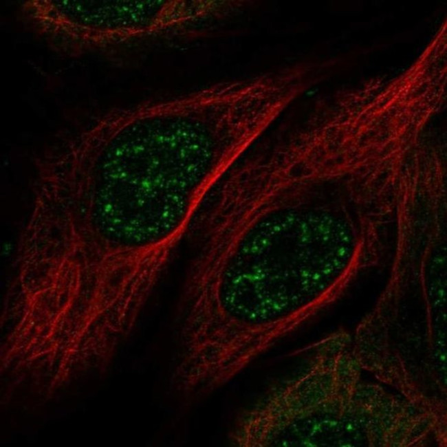 MAMSTR Antibody in Immunocytochemistry (ICC/IF)