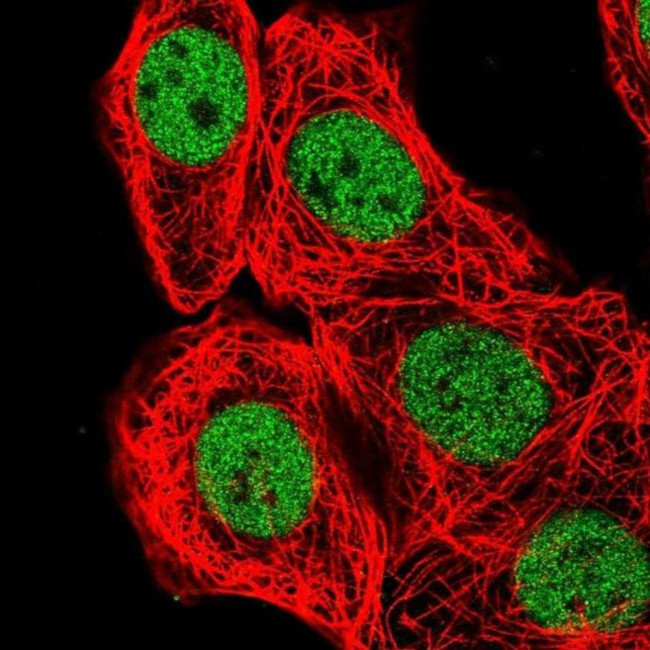 BCL7B Antibody in Immunocytochemistry (ICC/IF)