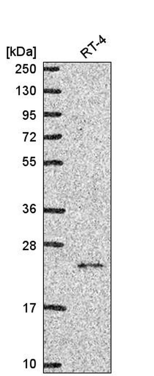 NCKIPSD Antibody in Western Blot (WB)