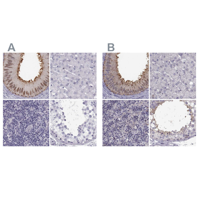 GPR64 Antibody in Immunohistochemistry (IHC)