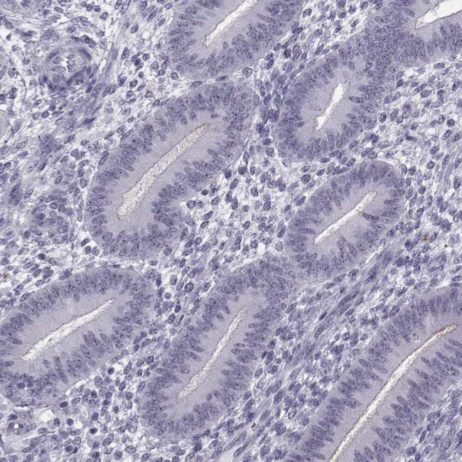 GPR64 Antibody in Immunohistochemistry (IHC)