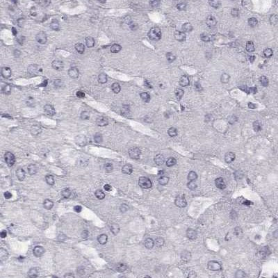 GPR64 Antibody in Immunohistochemistry (IHC)