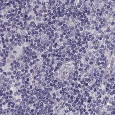 GPR64 Antibody in Immunohistochemistry (IHC)