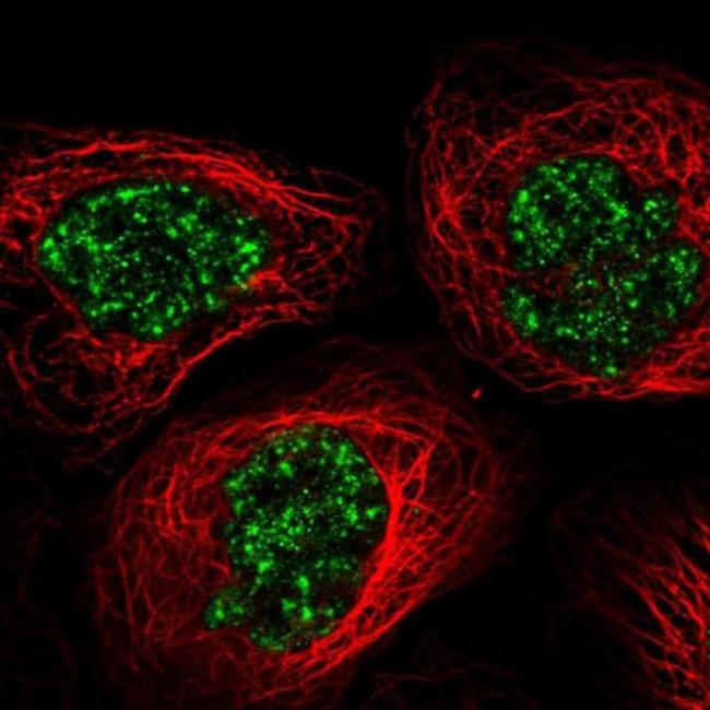 C11orf84 Antibody in Immunocytochemistry (ICC/IF)