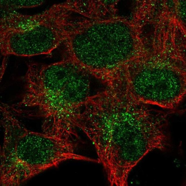 Cathepsin K Antibody in Immunocytochemistry (ICC/IF)