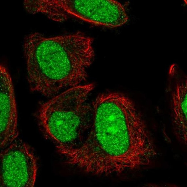 TRMT6 Antibody in Immunocytochemistry (ICC/IF)