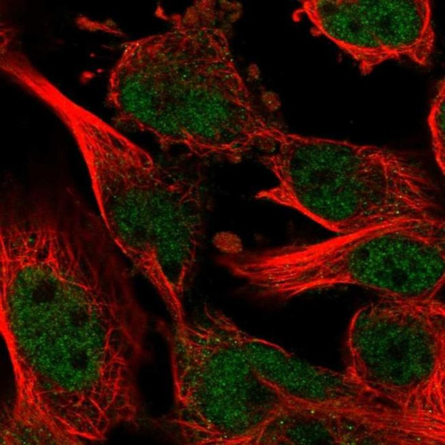 ZNF655 Antibody in Immunocytochemistry (ICC/IF)