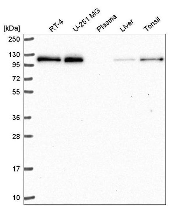 TREF1 Antibody in Western Blot (WB)