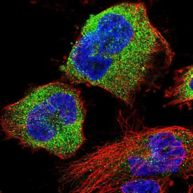 STK38L Antibody in Immunocytochemistry (ICC/IF)