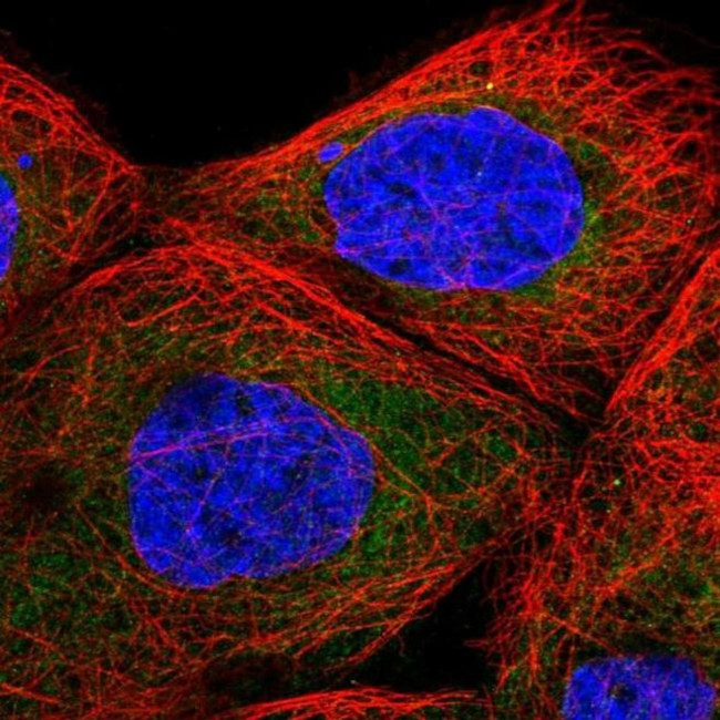 TBL2 Antibody in Immunocytochemistry (ICC/IF)