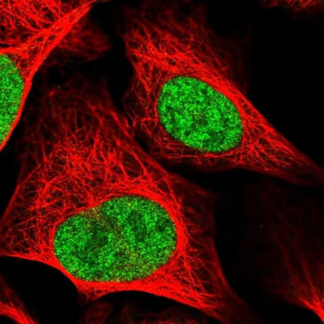 RAD54L Antibody in Immunocytochemistry (ICC/IF)