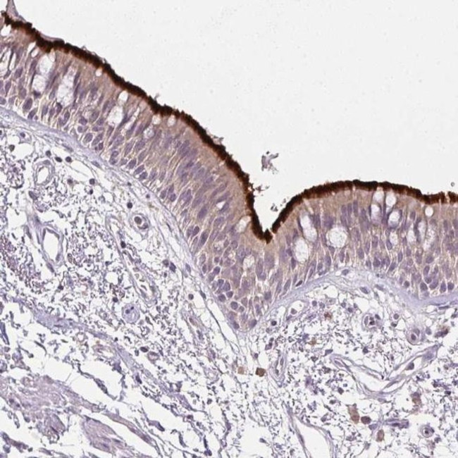 SPACA9 Antibody in Immunohistochemistry (IHC)