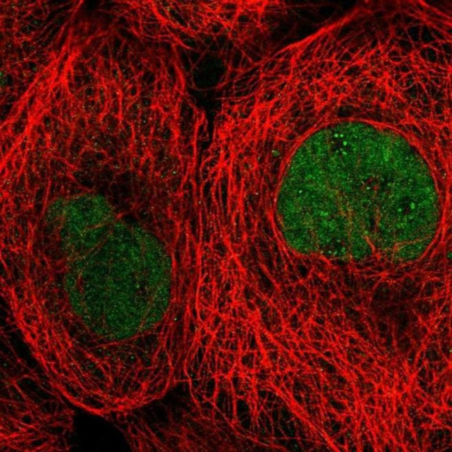 TBCK Antibody in Immunocytochemistry (ICC/IF)