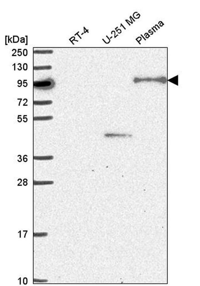 NOM1 Antibody in Western Blot (WB)