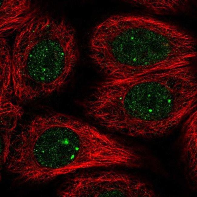 RAD51B Antibody in Immunocytochemistry (ICC/IF)