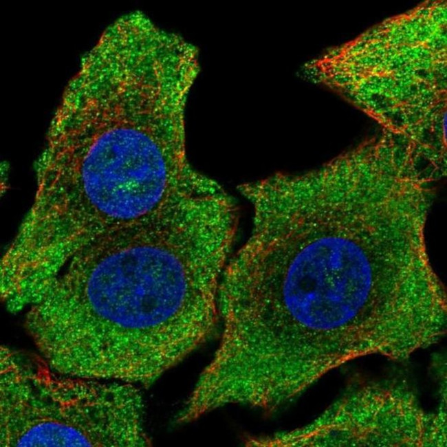 SHB Antibody in Immunocytochemistry (ICC/IF)