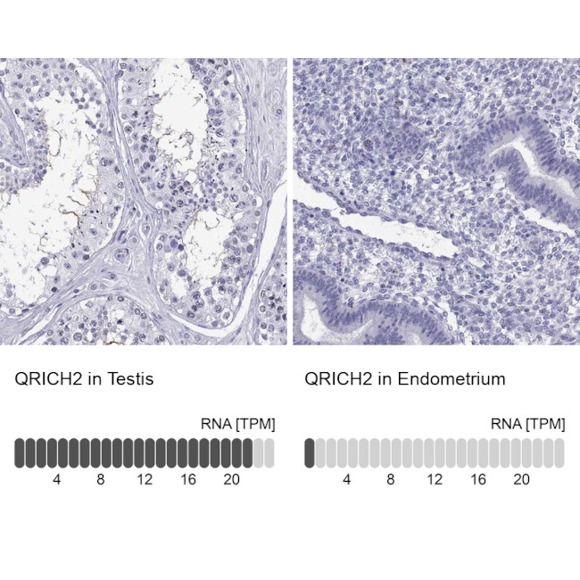 QRICH2 Antibody in Immunohistochemistry (IHC)