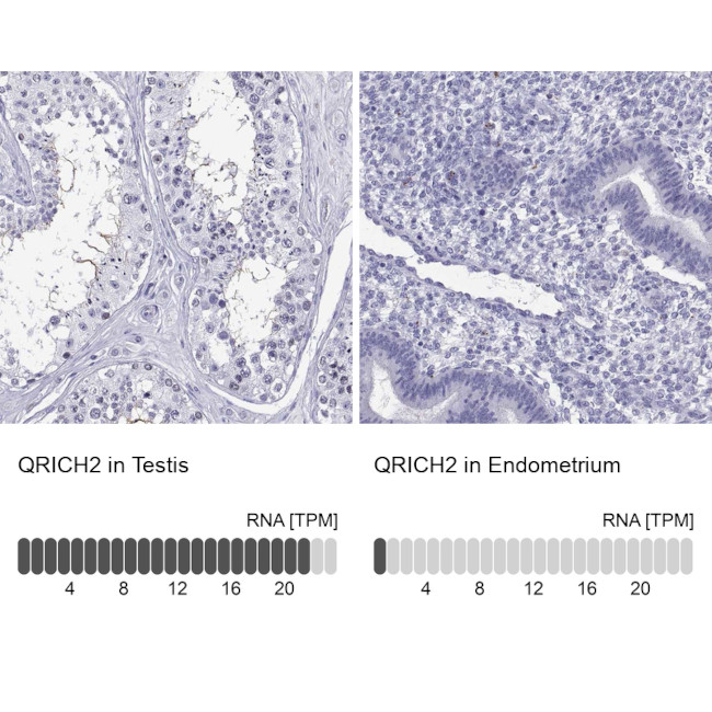 QRICH2 Antibody