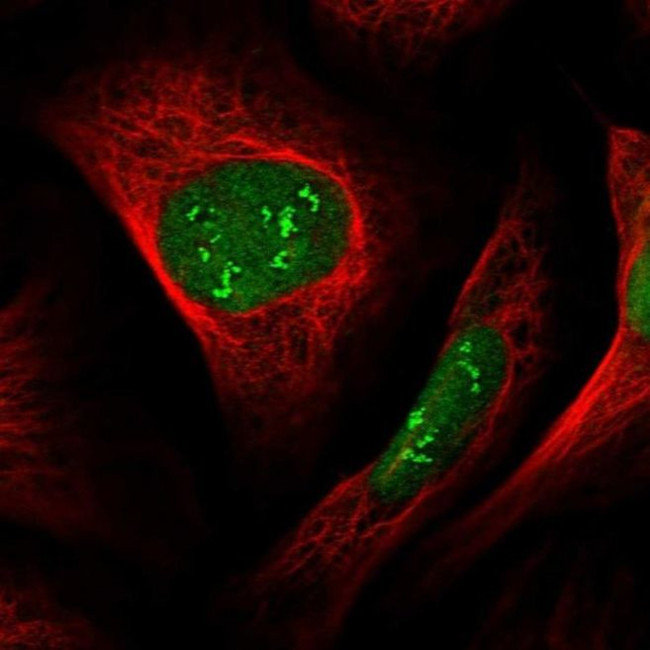 VPRBP Antibody in Immunocytochemistry (ICC/IF)