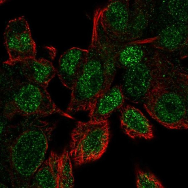 UBE2V1 Antibody in Immunocytochemistry (ICC/IF)