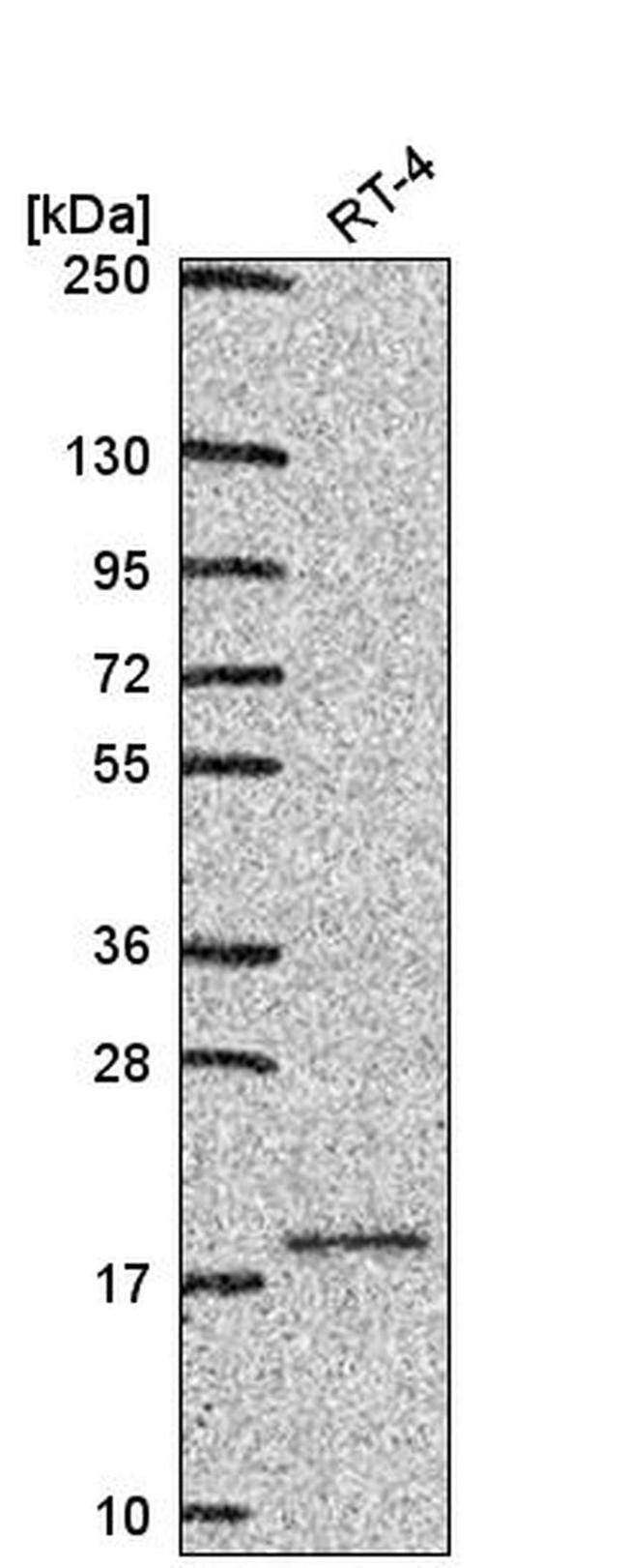 UBE2V1 Antibody in Western Blot (WB)