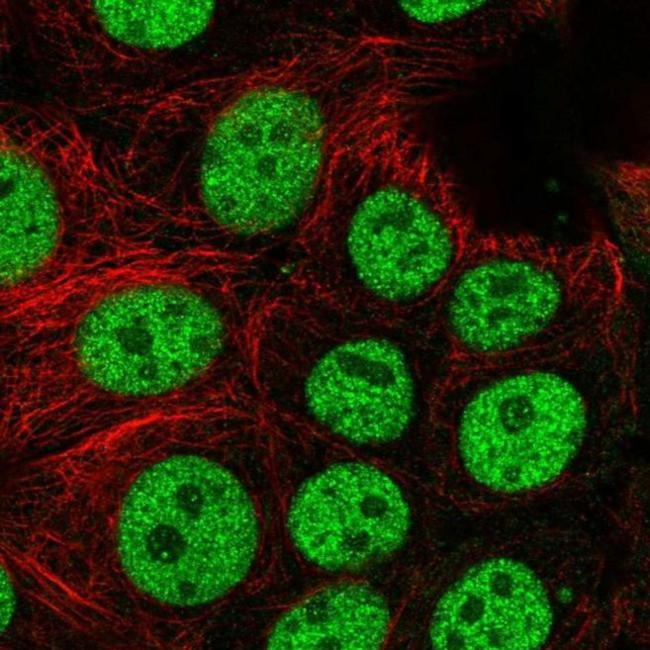 BCL7C Antibody in Immunocytochemistry (ICC/IF)