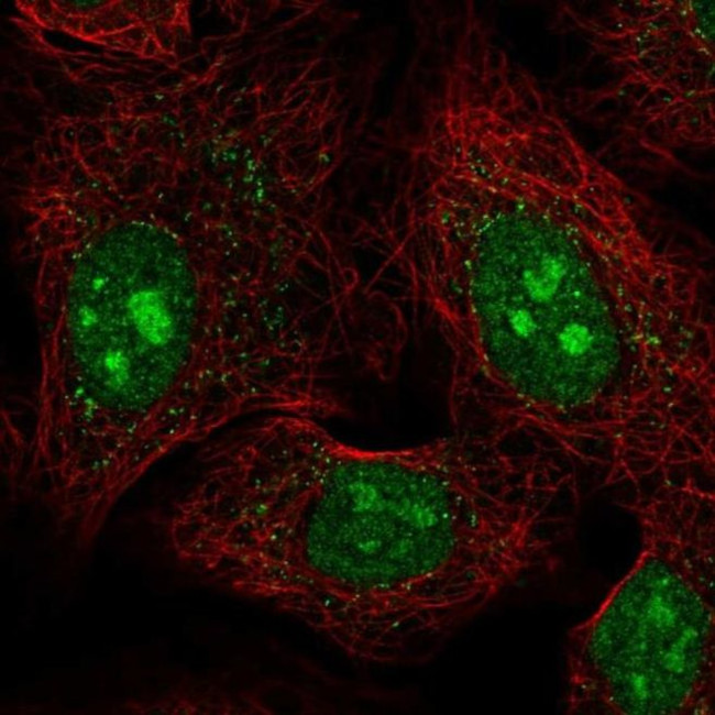 PCDHAC1 Antibody in Immunocytochemistry (ICC/IF)