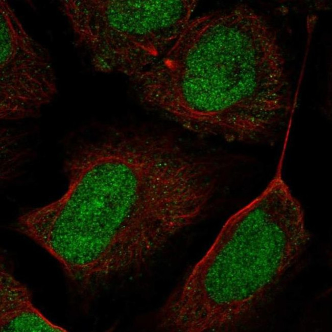 CHD7 Antibody in Immunocytochemistry (ICC/IF)