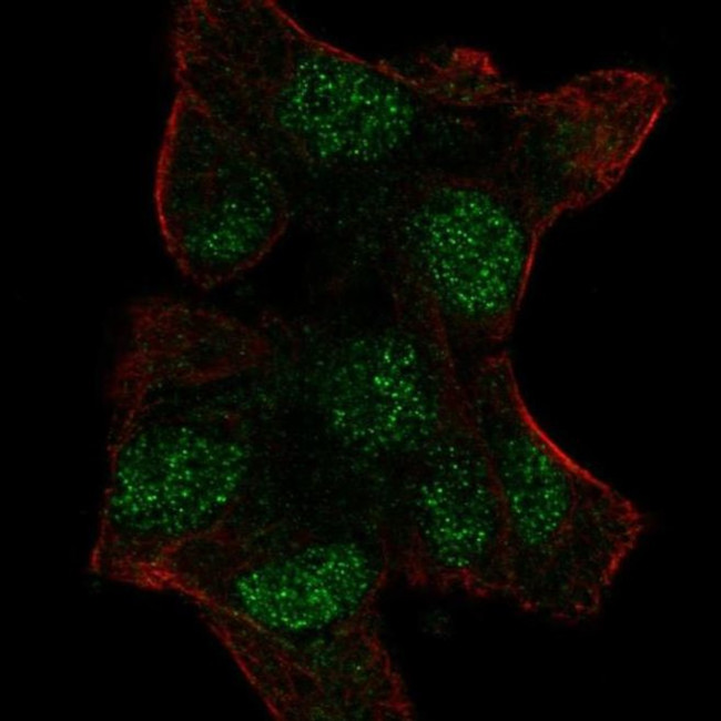 UBE2V1 Antibody in Immunocytochemistry (ICC/IF)