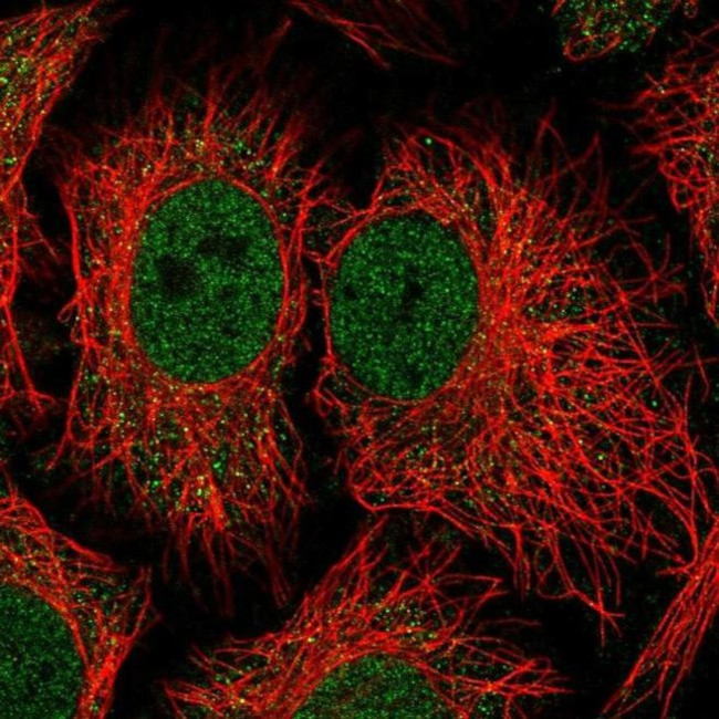 NADK Antibody in Immunocytochemistry (ICC/IF)