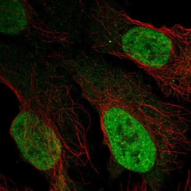 LAF4 Antibody in Immunocytochemistry (ICC/IF)