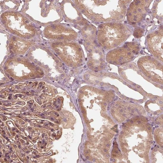 OTOGL Antibody in Immunohistochemistry (IHC)