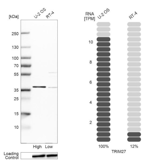 TRIM27 Antibody