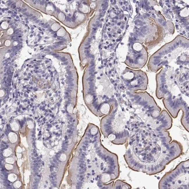 MYO1A Antibody in Immunohistochemistry (IHC)