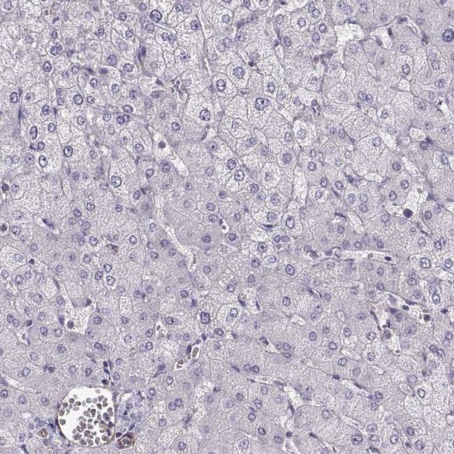 MYO1A Antibody in Immunohistochemistry (IHC)