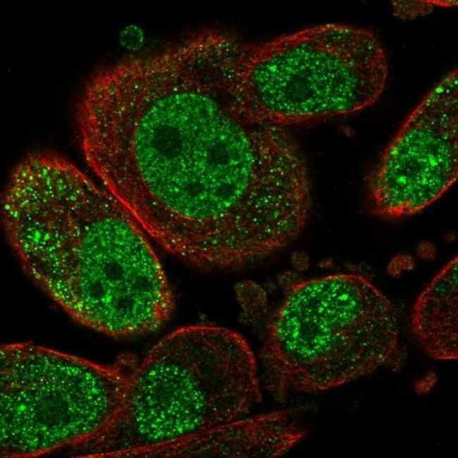 SETD6 Antibody in Immunocytochemistry (ICC/IF)