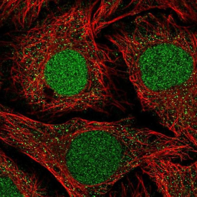 NFATC2IP Antibody in Immunocytochemistry (ICC/IF)