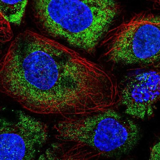 ABR Antibody in Immunocytochemistry (ICC/IF)