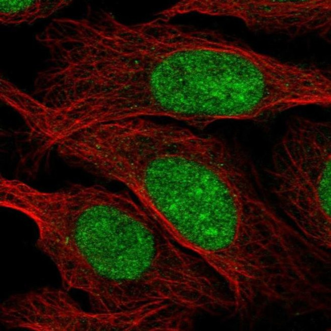 ZZZ3 Antibody in Immunocytochemistry (ICC/IF)