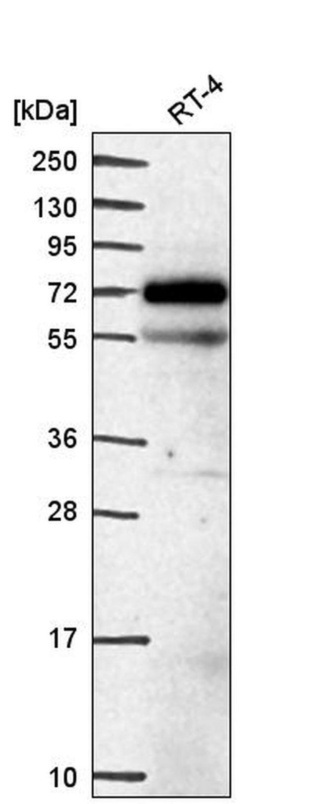 EEPD1 Antibody in Western Blot (WB)