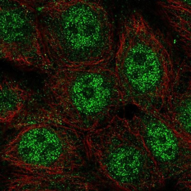 WDYHV1 Antibody in Immunocytochemistry (ICC/IF)