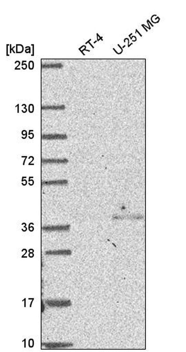 DC8 Antibody in Western Blot (WB)