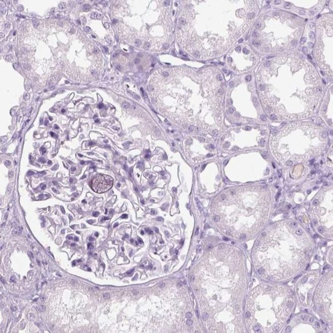 KRTAP11-1 Antibody in Immunohistochemistry (IHC)