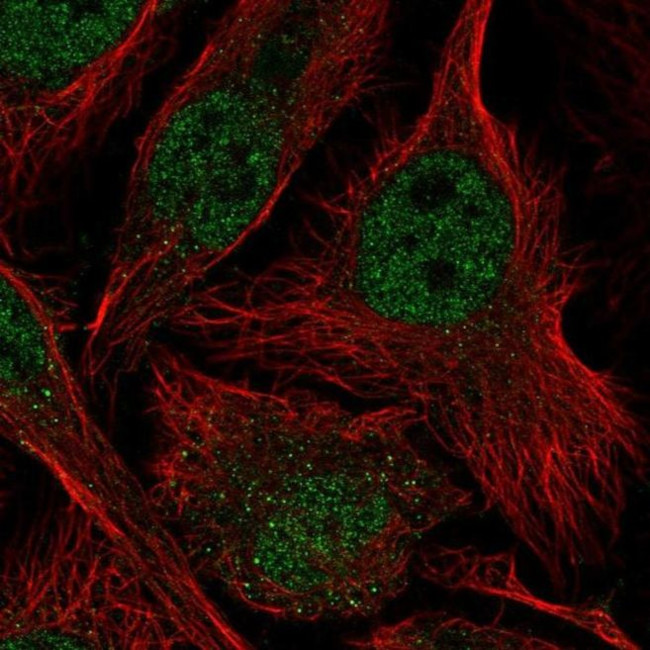 ASF1B Antibody in Immunocytochemistry (ICC/IF)