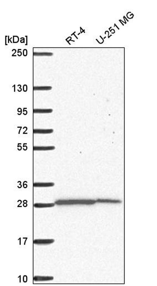 UPP1 Antibody in Western Blot (WB)