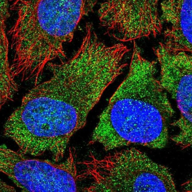 YTHDF2 Antibody in Immunocytochemistry (ICC/IF)