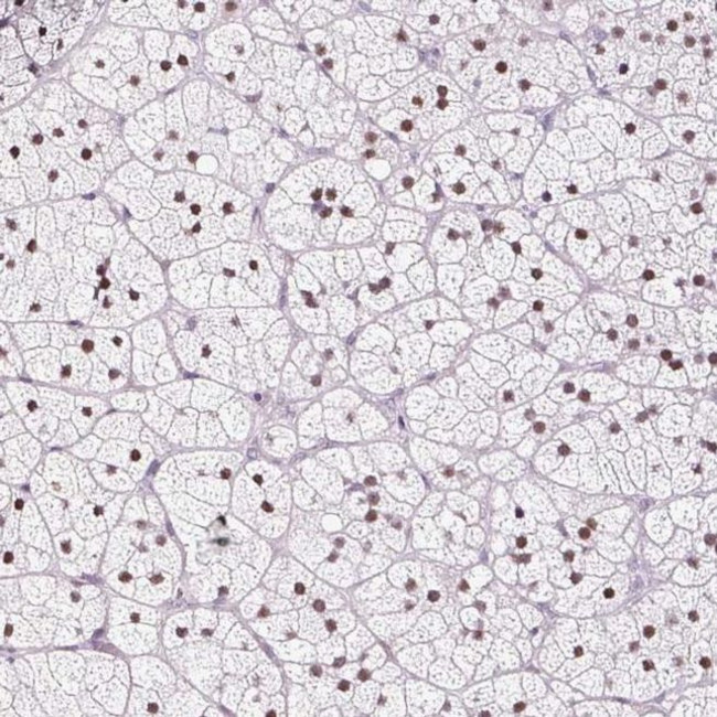 PDE6B Antibody in Immunohistochemistry (IHC)