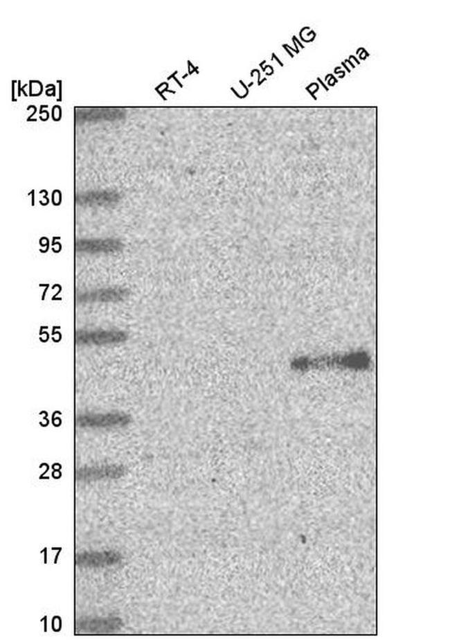 ELOVL5 Antibody in Western Blot (WB)